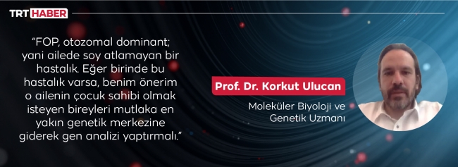 Nadir görülen FOP hastalığı bedeni taş gibi hareketsizleştiriyor
